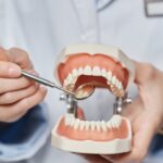 264826-caries-interproximal-consecuencias-de-este-problema-silencioso-que-afecta-la-salud-bucal