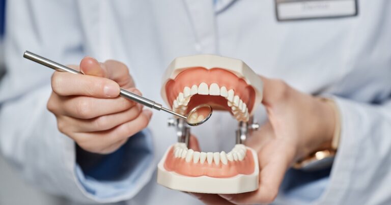 Caries interproximal: consecuencias de este problema silencioso que afecta la salud bucal